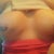You can visibly see the indent on the breast on the left which is actually my right breast.