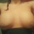 This is without the wrap pushing them up and you can still see the indentation clearly. There is a big difference between the two breasts and their roundness. The left is more swolen right now because I am left handed which is common. Most women experience more swelling in the breast of their primary hand.