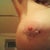 Here are some close ups of the indentation. The tissue above my indented breast is squishy and soft like my old breast the left breast however is hard and round like to rest of my breast. It is so odd...