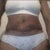 4 weeks po front