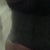 post-op five weeks love my roundness