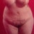 4 weeks post op