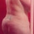 4 weeks post op