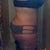 12 weeks post op