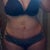 12 weeks post op