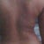 2 Days psot op
