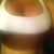 monday aug20 they swelling is starting to go down