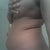 Bra Roll Before- 12/3/12