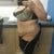 16 days post op side picture in my doctors office