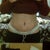 Front view 2 wks po