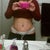 As you can see Im still swollen. But so far I'm happy. I have some discoloration. Which my ps said is normal.