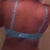 Back Day 4 post op