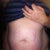This is two YEARS after giving birth and my stretch marks suck!!!