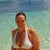 My stomach 5 months before the surgery.  I had to wear a sarong even in the water to feel halfway comfortable.