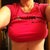 8 weeks post op front view