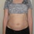 Relaxing my muscles, my stomach distends because of the separation.