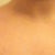 Shoulder ridges