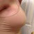 See how the Gap Body bra smooths the upper-pole fullness I'm still having? :) ignore armpit hair...it's hard to shave. 1 week PO