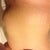 Right side stretch marks goodness there everywhere.  lol