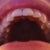 Top teeth - I see no improvement from the first shot I uploaded like this.