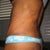 Left side 2 weeks post