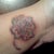 Treatment 2, nine hours post 
You can kind of see by the indentation in my skin on the bottom of my wrist how swollen it is.