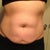 Before front
