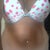 preop front view