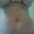 another preop front view