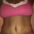 Tape was removed from incision. Spot on the left is where my last drain was removed. The hole from the first drain has already closed. My PS lined the drain holes up w/ my incision. In his words....so I don't end up with 2 little eyes in my pubic area.