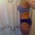 3 1/2 months post- op