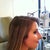 Day of cast removal profile view