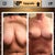 Before and after