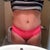 2 Months Post Op