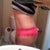 2 Months Post Op