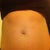 Before procedure front view - normally tightened muscles