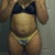 8/27/2012 before i started taking vitamis