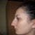 Before profile