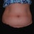 Lower abdomen and love handles