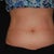Lover abdomen and love handles 3months after
