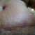 Close up of scar and stretch marks. They are now above my bb.