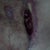 Its side ways. But this is my incision tat was opened to allow the fat necrosis to drain