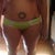 Front view of my tummy before surgery