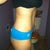 4.5 months post op