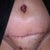 Bloody belly button 2/26/12