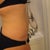 4 months PO side view