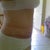 27 days after surgery
