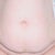 Before surgery picture