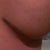 My scar