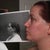 Day 23 Chin with Preop Chin photo